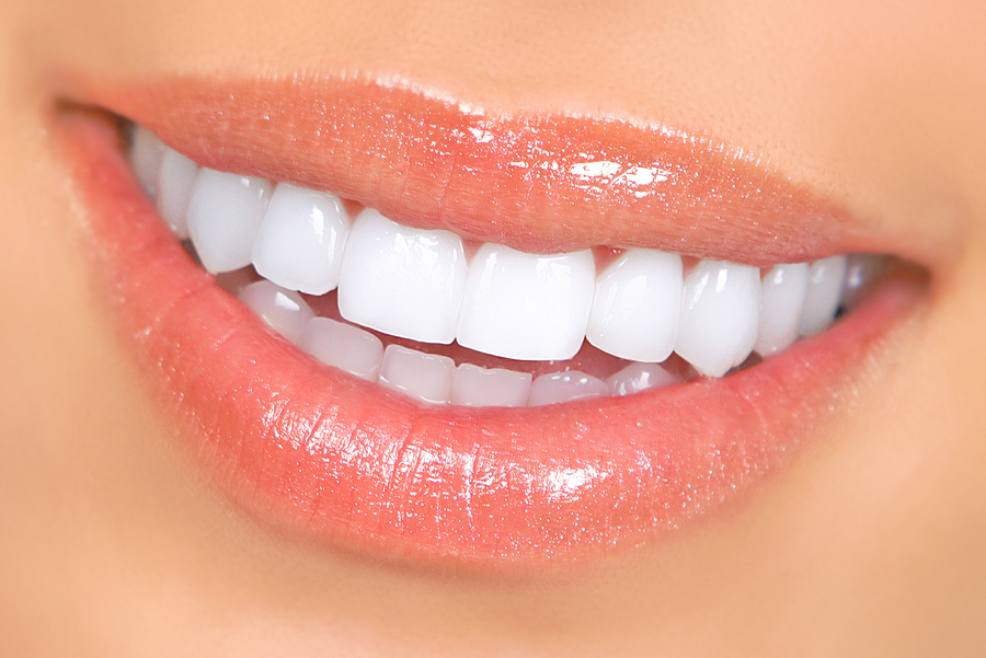 Is Veneers a Good Option for You to Consider?